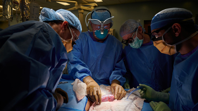 photo of a group of surgeons examining the pig kidney for signs of rejection